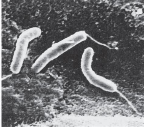 Vibrio And Related Bacteria Vibrio Vibrio Cholerae Cholera Vibrio