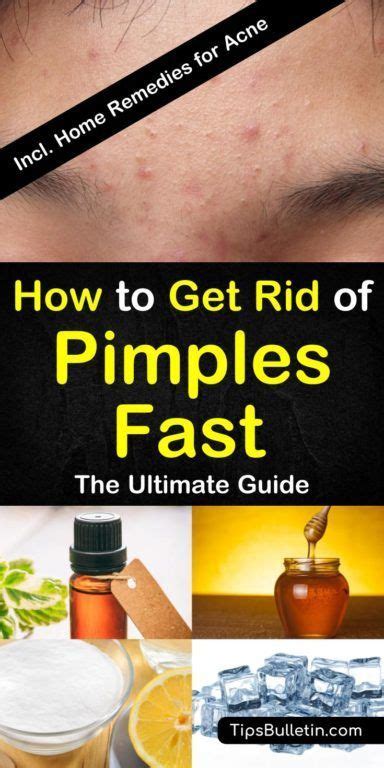 8 Great Home Remedies To Get Rid Of Pimples Fast How To Remove