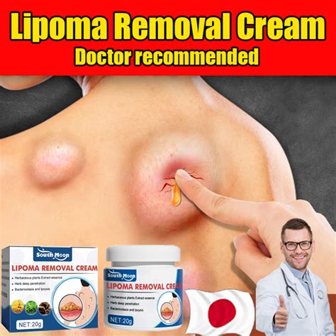 Obat Benjolan Obat Lipoma Obat Benjolan Di Leher Salep Benjolan Obat