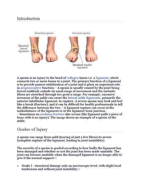 Ligament Sprain | PDF