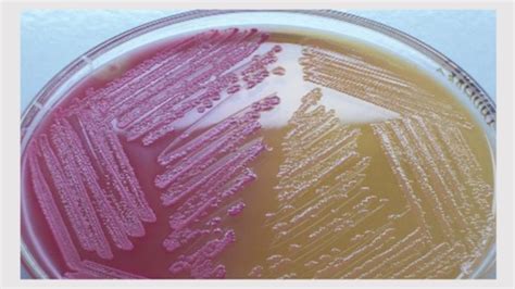 Gram Negative Bacilli Lactose Fermenter Flashcards Quizlet