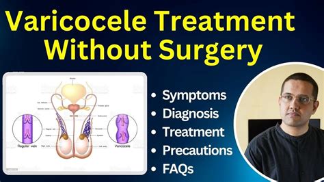 Varicocele Symptoms Diagnostic Best Treatment Faq Dr Gaurav