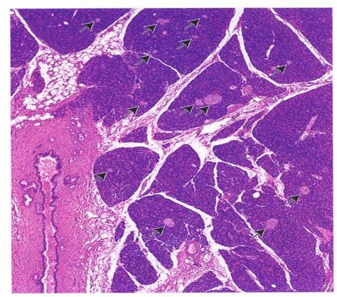 Histo Exam Digestive Ii Flashcards Quizlet