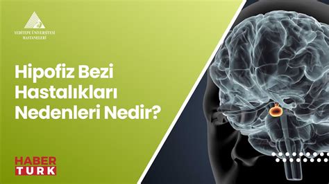 Hipofiz Bezi Hastalıkları Nedenleri Nedir YouTube