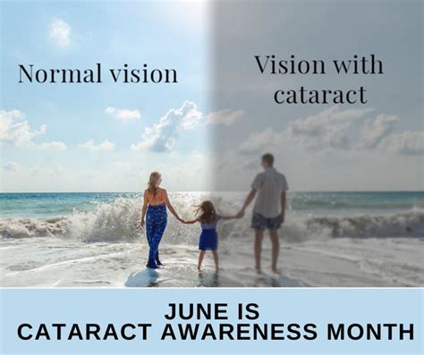 June Is Cataract Awareness Month Eyecare Associates Of New Orleans