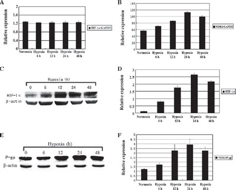 Figure 1 From Expression And Significance Of Hypoxia Inducible Factor