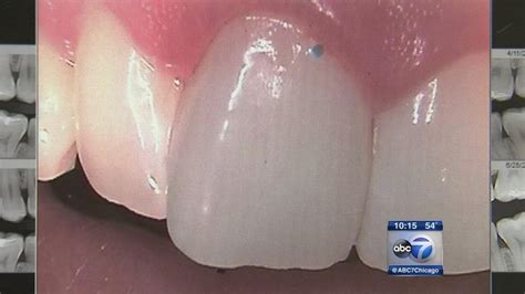 Tiny bubbles: I-Team uncovers plastic microbeads in toothpaste | abc7chicago.com