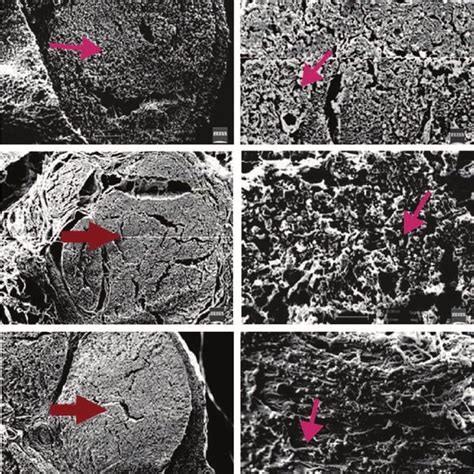 Scanning Electron Microscopic Examples In Group B All Sciatic Nerve