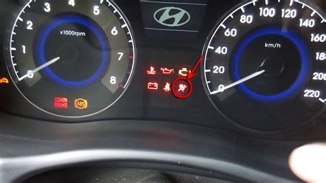 Информационный дисплей Hyundai Solaris