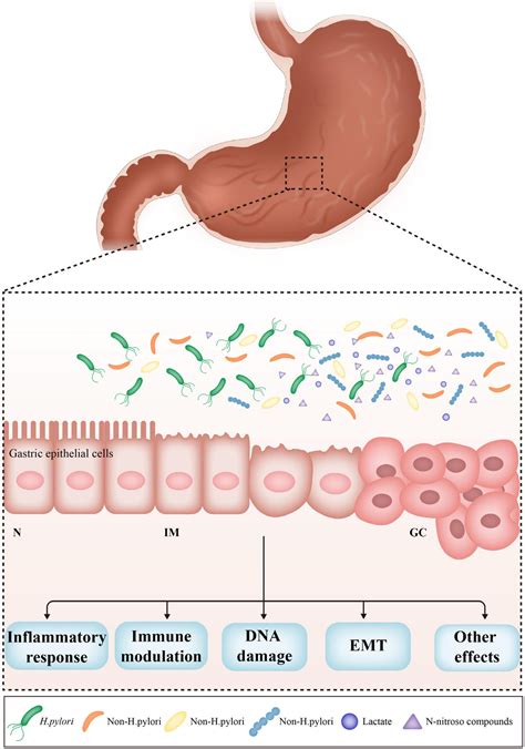 Frontiers Role Of The Gastric Microbiome In Gastric Cancer From Carcinogenesis To Treatment