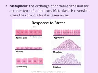 Metaplasia: What Is It, Types, Causes, And More Osmosis, 59% OFF