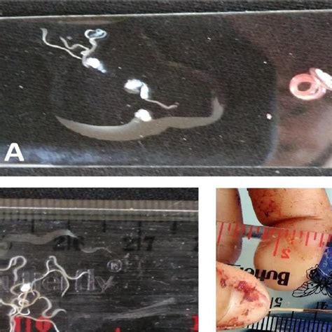 Small Cysts And Nematodes In Slide With A Large Nematode In Right A Download Scientific