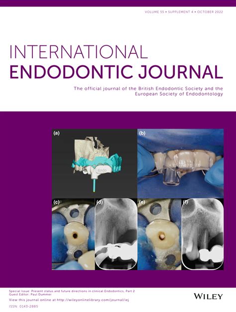 Present Status And Future Directions In Clinical Endodontics Part 2