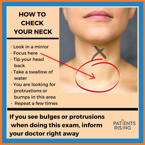 Thyroid Nodule — How To Test For Thyroid Cancer