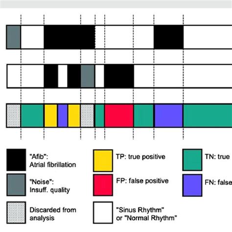 Conceptual Illustration Of Atrial Fibrillation Burden Classification