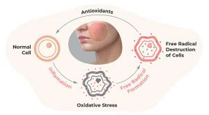 Top 3 Reasons to Use Antioxidants in Your Skin Care - Dr. Karen O'Neill