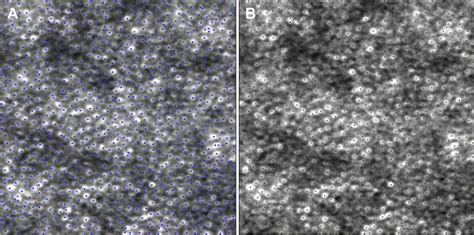 Repeatability And Reproducibility Of Photoreceptor Density Measurement