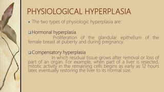 Hyperplasia (1) | PPT