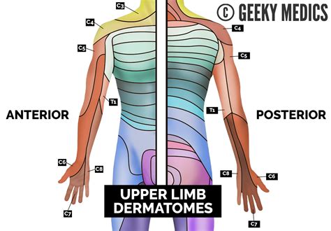 Dermatome Upper Limb