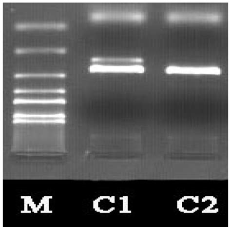 Hla Cw Genotyping By Pcr Ssp M Marker C Pcr Ssp Products Of