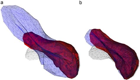 Figure 5 From Real Time Visio Haptic Interaction With Static Soft Tissue Models Having Geometric