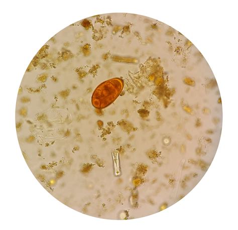 The Pathology Test Ova Cysts And Parasites