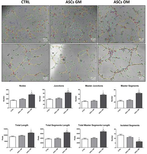 Evaluation Of The Angiogenic Potential Of HMECs In The Presence Of