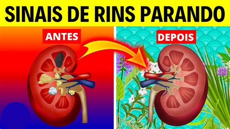 Rins Parado Pode Voltar A Funcionar