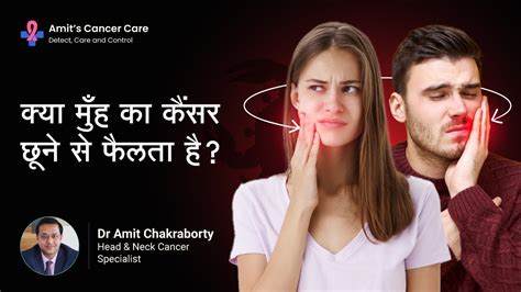 क्या मुँह का कैंसर छूने से फैलता है Is Oral Cancer Contagious Dr