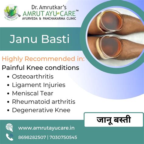 Knee Pain Ayurvedic Treatment Janu Basti Retain