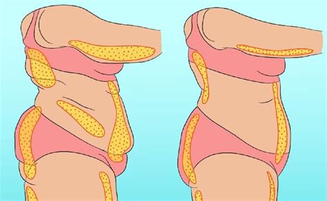 Cu Les Son Los Diferentes Tipos De Grasa En El Cuerpo Humano