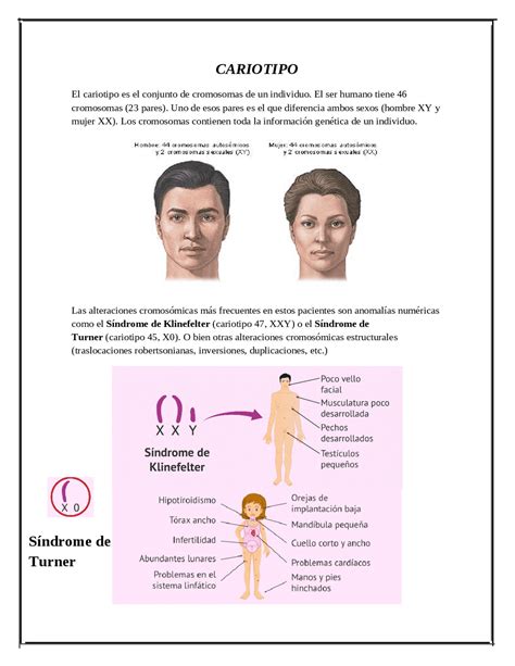 Sindrome De Klinefelter En Mujer