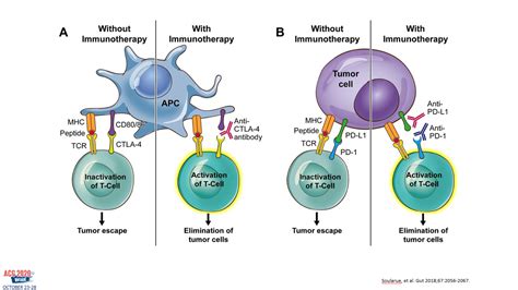 Checkpoint Inhibitor Immune Related Gi Adverse Events Acg