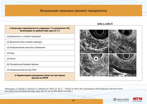 Эндоскопическая ультрасонография (ЭУС) | Делга-Медис