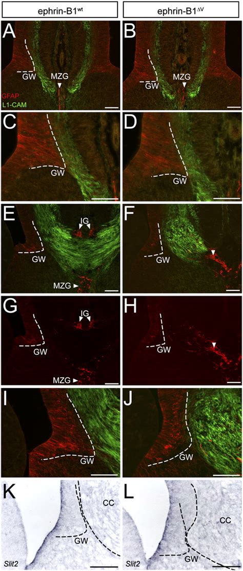 Ephrin B Regulates Axon Guidance By Reverse Signaling Through A Pdz