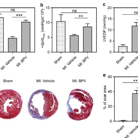 PTEN Inhibitor Activated PI3K Akt VEGF Signaling Pathway In MI Mice