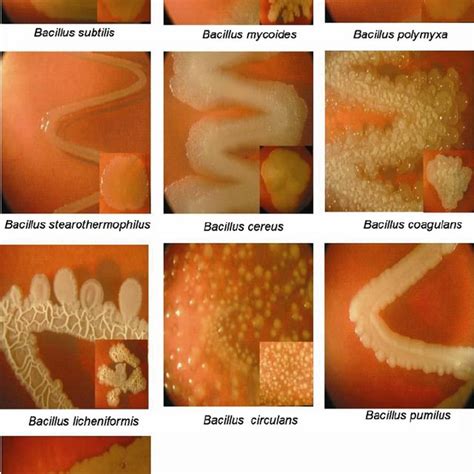 6 Diversity In Bacillus Species Isolated From Rhizosphere Soil Of