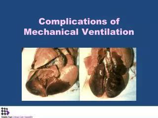 PPT - Complications of Mechanical Ventilation PowerPoint Presentation, free download - ID:3087108