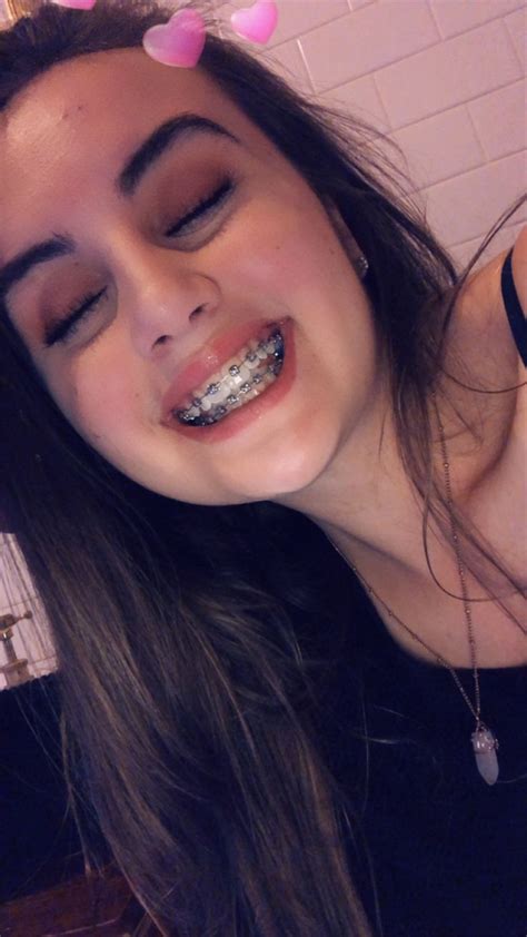 What Are The Cutest Colors For Braces Malisa Donohue