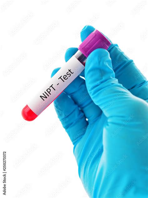 Blood Sample For Nipt Or Non Invasive Prenatal Testing Diagnosis For