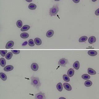 Haemolysis Of Common Carp Red Blood Cells Haemolysed Erythrocytes Are