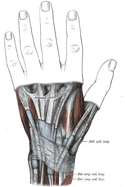 Devils Horn Sign • Litfl • Clinical Cases Bamboozler