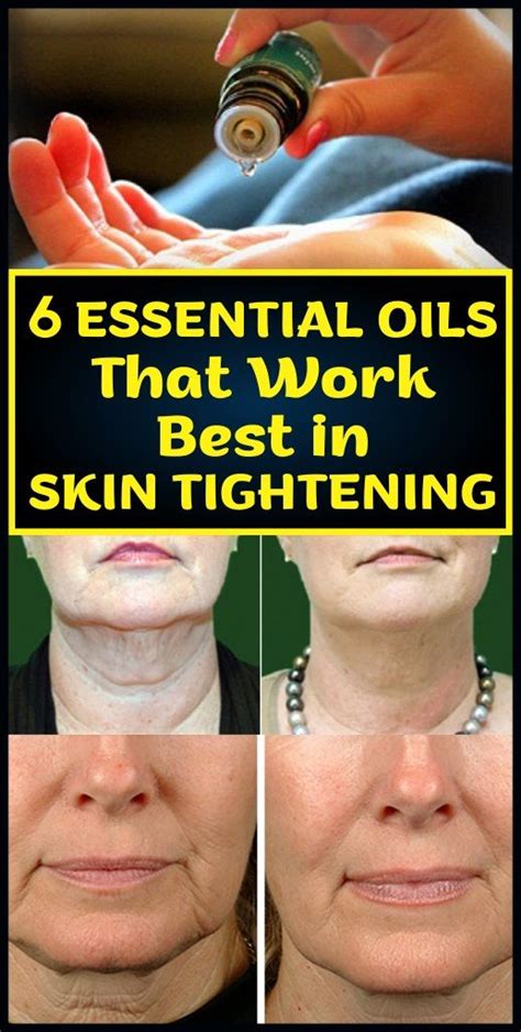 6 Essential Oils That Work Best In Skin Tightening Healthcare Important