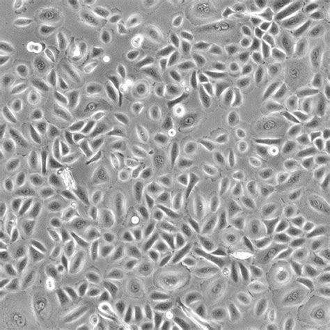 Human Conjunctival Epithelial Cells Innoprot Ocular Cell System