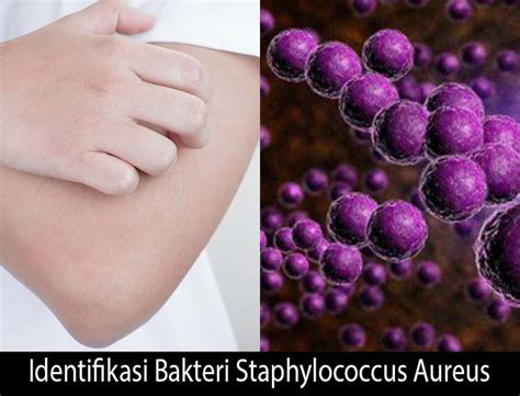 Identifikasi Bakteri Staphylococcus Aureus Metode Lengkap