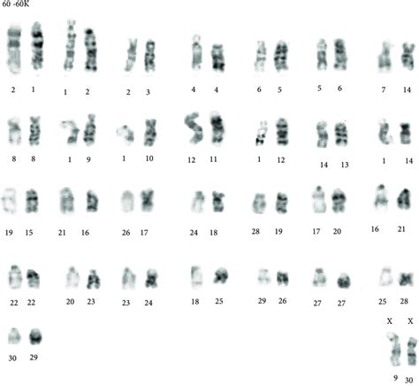 Chromosome Banding Comparisons Between The Following Chromosomal Races Download Scientific