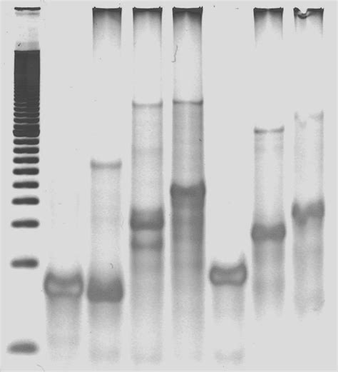 gel image  scientific diagram