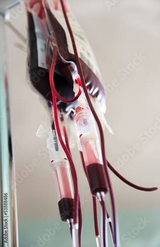 Bluttransfusion Buy This Stock Photo And Explore Similar Images At