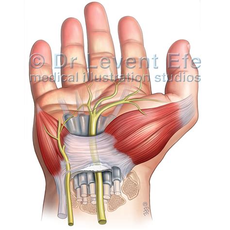 Carpal Tunnel Anatomy and the Carpal Tunnel Syndrome | Dr. Efe’s Medical Art Store: Medical ...