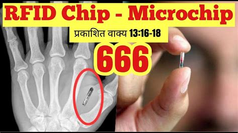 RFID Chip 2020 Microchip 666 Revelation 13 16 18 YouTube